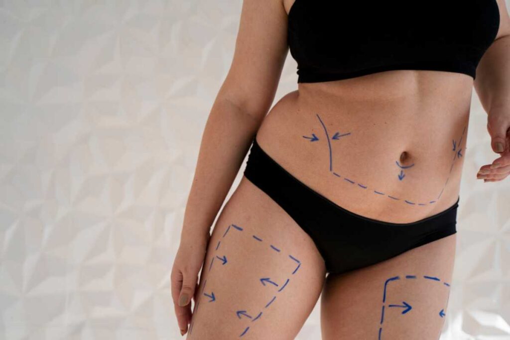 o-que-e-abdominoplastia:-guia-completo-do-procedimento