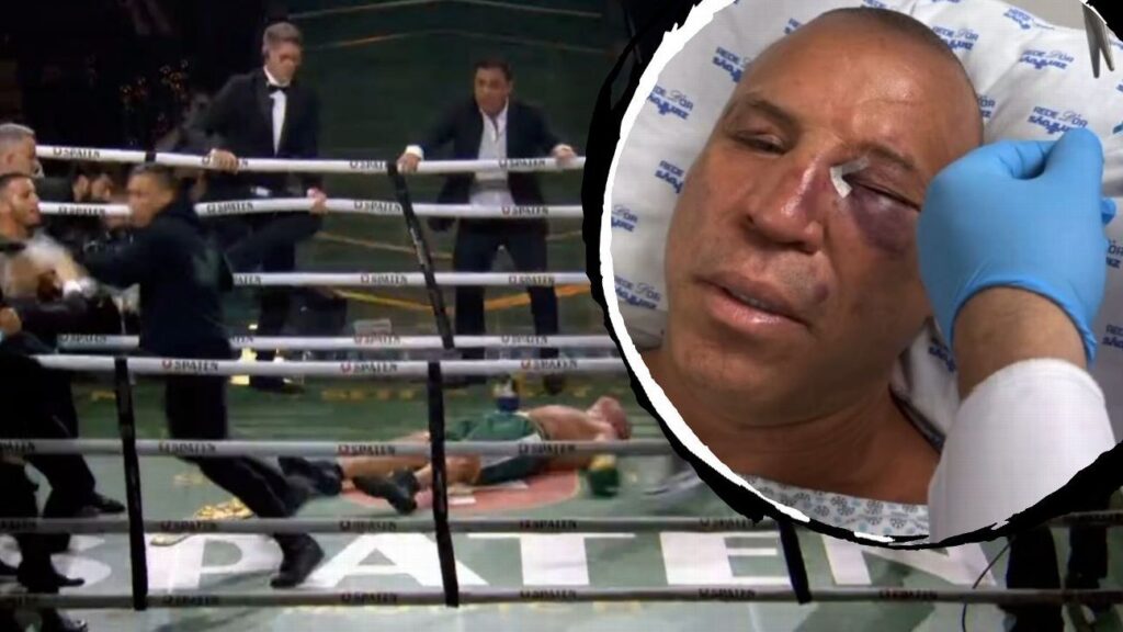 como-wanderlei-silva-ficou-apos-briga-em-ringue